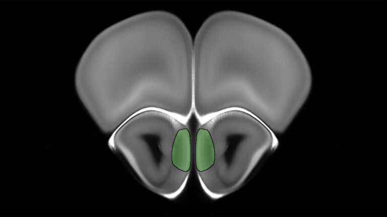 electron microscopic image of a mouse brain odor processing center