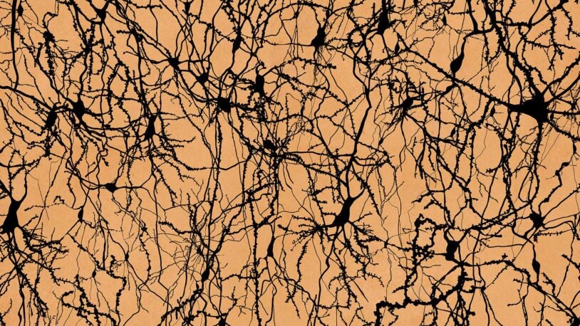 image of human brain neurons